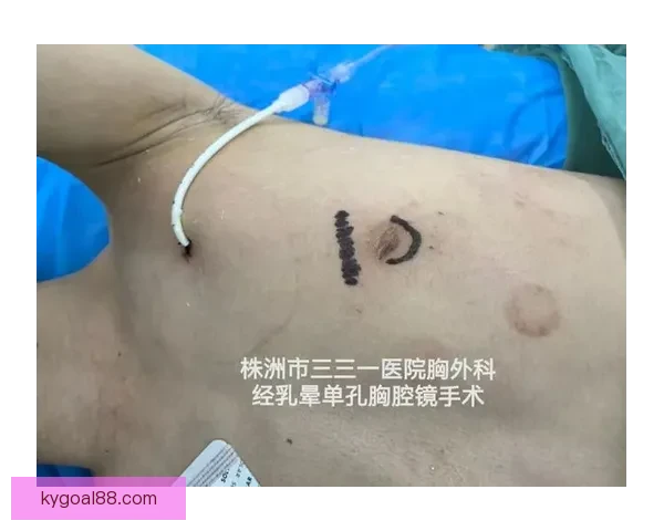 坎宁安气胸康复持续推进 活塞计划一周后复查评估